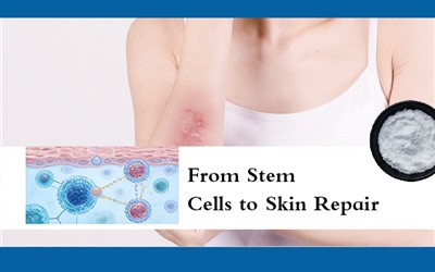Od matičnih ćelija do popravke kože