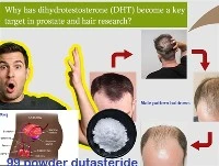 Zašto je DHT postao ključna meta u istraživanju prostate i kose