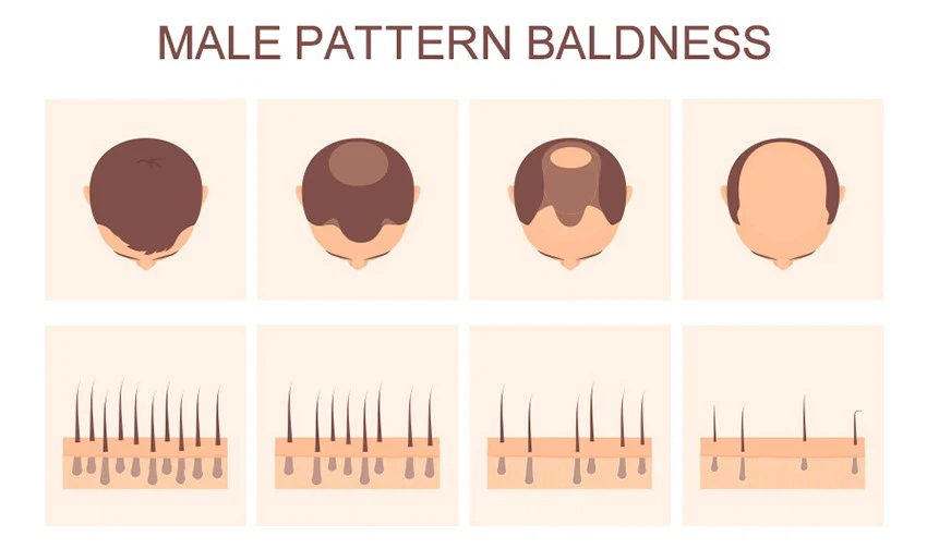 850-484Topilutamide 850-484Topilutamide