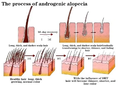 9Beat Summer Hair Loss A 9Beat Summer Hair Loss A