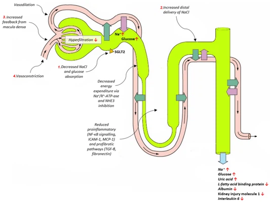 Epagliflozin lowers blood glucose by inhibiting the SGLT2 transporter in the kidneys Epagliflozin lowers blood glucose by inhibiting the SGLT2 transporter in the kidneys